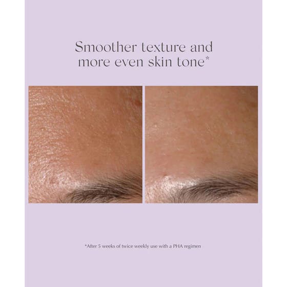 Performance Peel AP 25