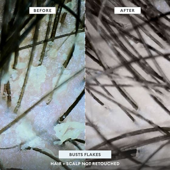 Scalp Revival™ Dandruff Relief Shampoo