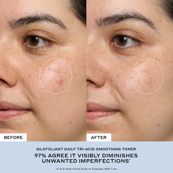 Transform Exfoliating Treatment Toner