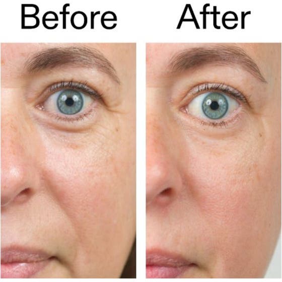 Bio-Active Ceramide Repairing and Plumping Moisturizer