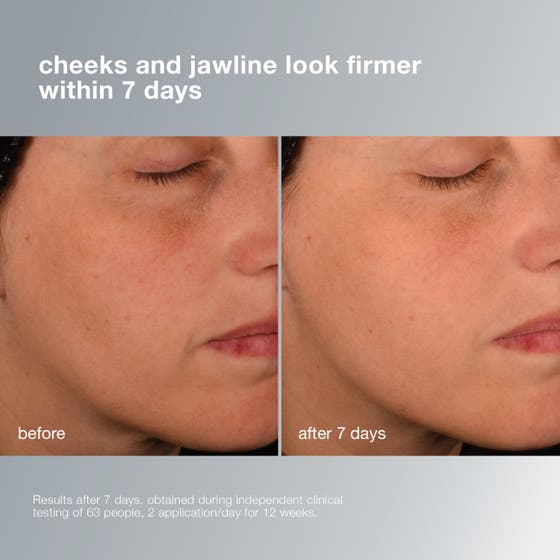 Dermalogica Pro-Collagen Banking Serum 30 ml viser fastere hud på kinn og kjevelinje før og etter 7 dager.