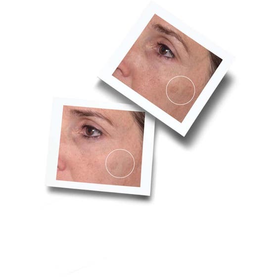 Dark Spot & Sun Protection Essentials