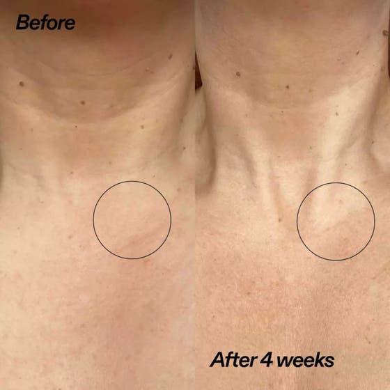 Bio-Active Ceramide Neck Lift Stick
