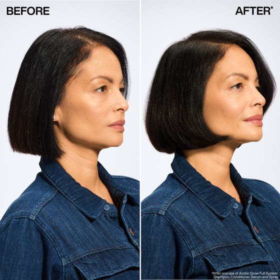 Acidic Grow Full System Scalp & Hair Serum