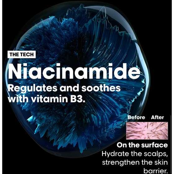 Scalp Advanced Anti-Dandruff Shampoo