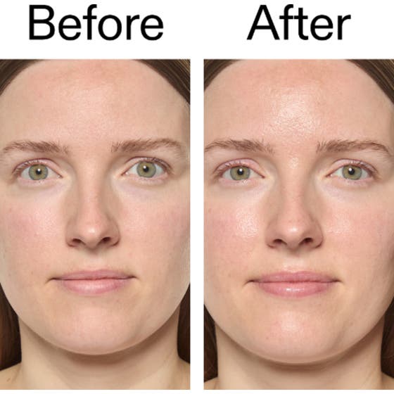 The INKEY List Exosome Hydro-Glow Complex 30 ml serum viser før og efter billeder med synlig glød og fugt