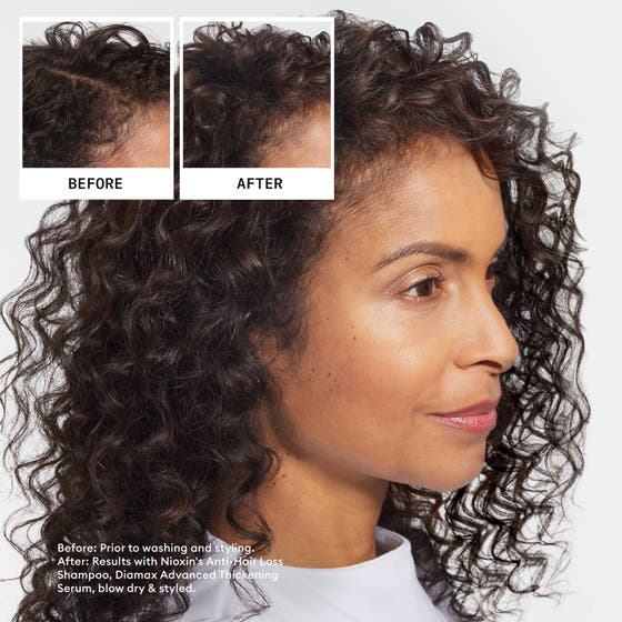 Hair Density Starter Set