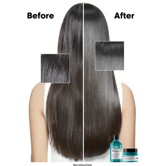 Scalp Advanced Anti-Oiliness Shampoo