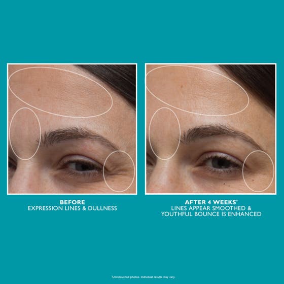 Peptide Skinjection™ Moisture Infusion Cream