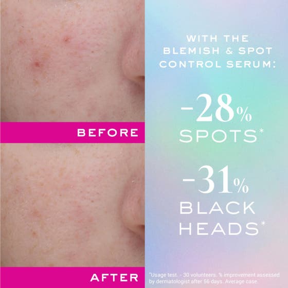 Nuxe Zinc Power Blemish And Spot Control Serum 30 ml epäpuhtauksia hoitava seerumi holografisessa pakkauksessa.
