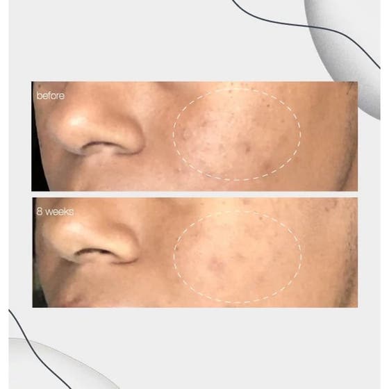 PowerBright Dark Spot Serum Duo