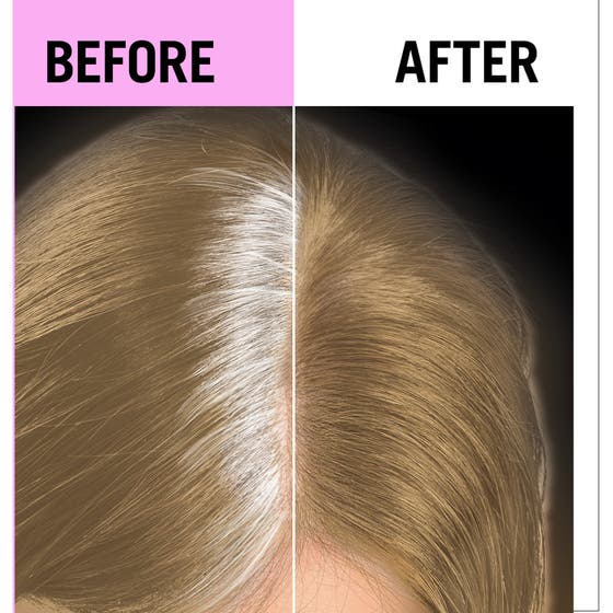 Schwarzkopf Root Retouch Permanent Color