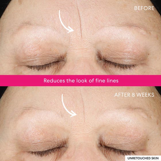 Ageless Phyto-AHA Radiance Facial