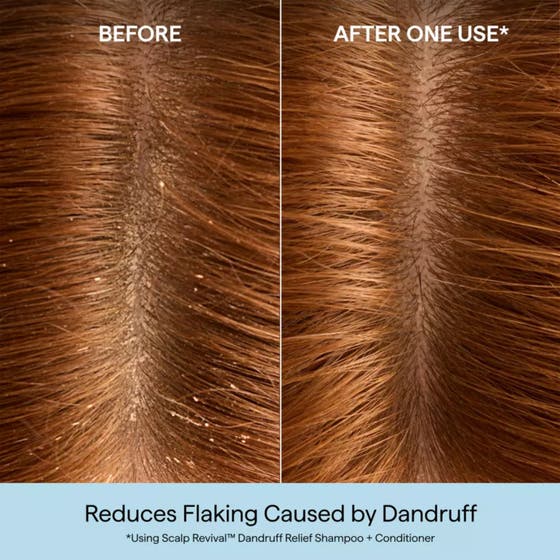 Scalp Revival™ Dandruff Relief Shampoo