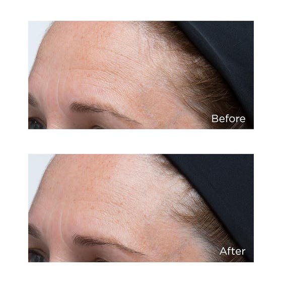 High Potency Classics