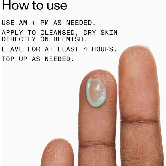 Succinic Acid Treatment