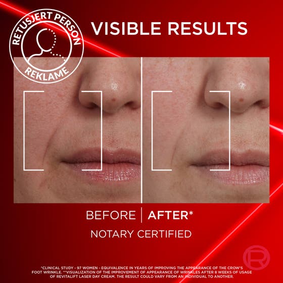 L'Oréal Paris Laser Advance Day 50 ml anti age ansiktskräm ger huduppstramning och lyster på bild med kvinna.