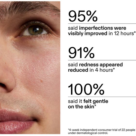 Succinic Acid Treatment