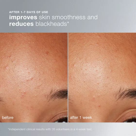 Dermalogica Daily Microfoliant 74 g peeling for jevnere hud viser finkornet hvitt pulver og luftig skum med bobler