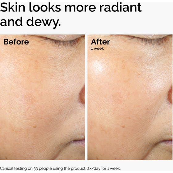 Rice Lipids + Ectoin Microemulsion