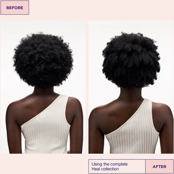 Scalp Healing Essentials With Detangler