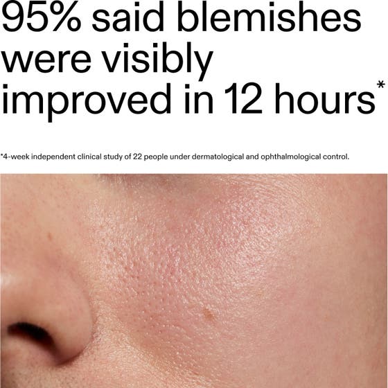 Succinic Acid Treatment