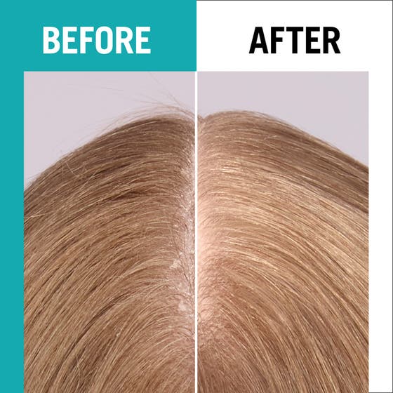 Gliss Scalp Balance Scalp Spray