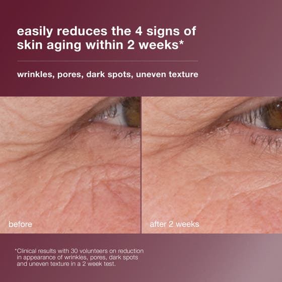 Dermalogica Dynamic Skin Retinol Serum 30 ml påføres huden med tekst om 3.5% high-dose retinol.