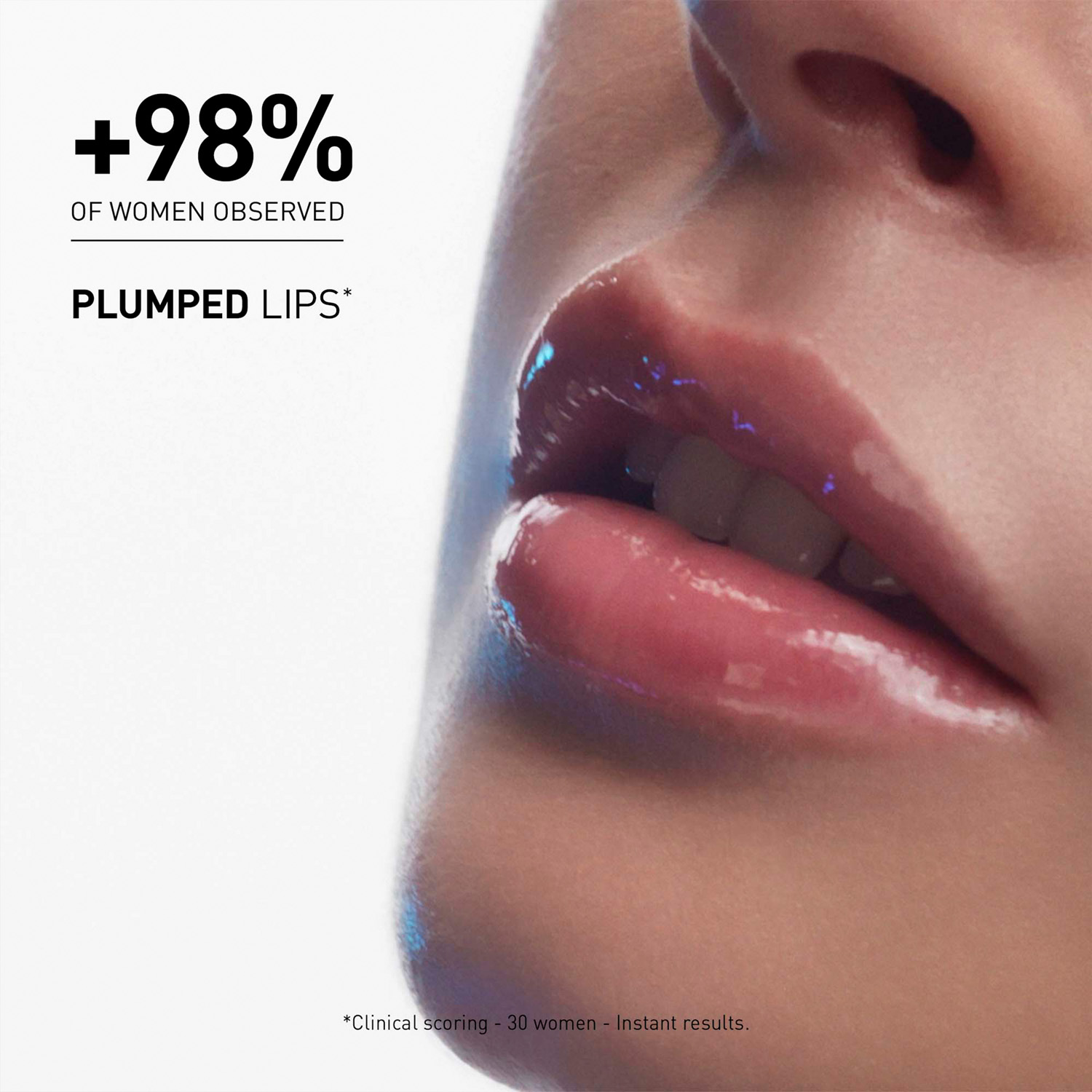 Hyalu-Filler Lips