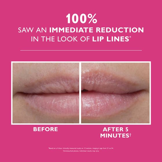 Instant Firmx® Lip Filler
