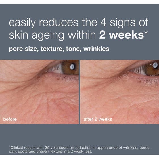 Dynamic Skin Recovery SPF50 & Dynamic Skin Retinol Serum