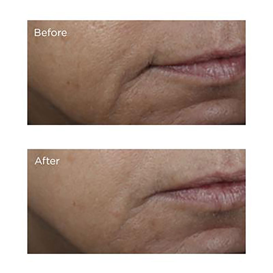 Vitamin C Ester Brightening Amine Face Lift