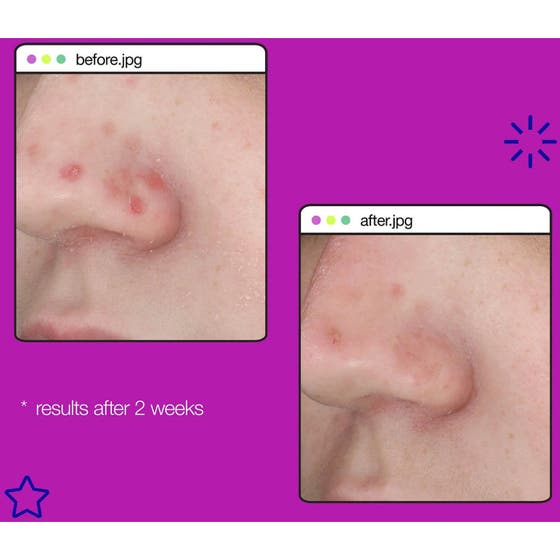 Post-Breakout Fix Duo