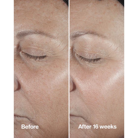 Advanced Repair & Anti-Age Eye Set