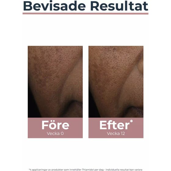 Antipigment Spot Corrector