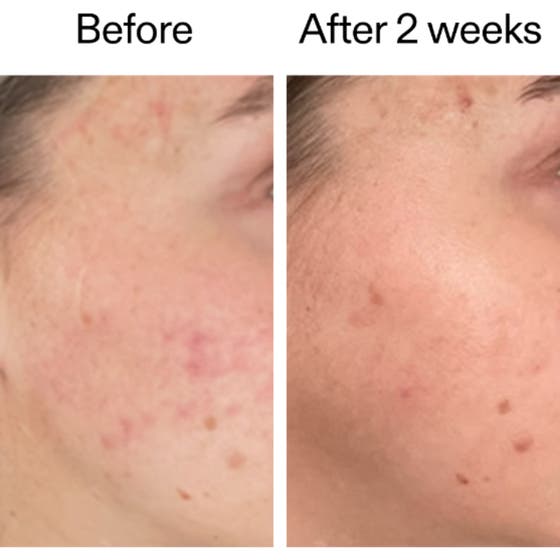 360 Skin Clearing Serum