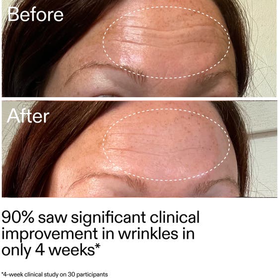 Starter Retinol Serum