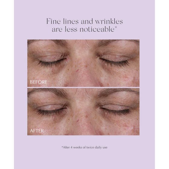 Age Reverse Eye Contour