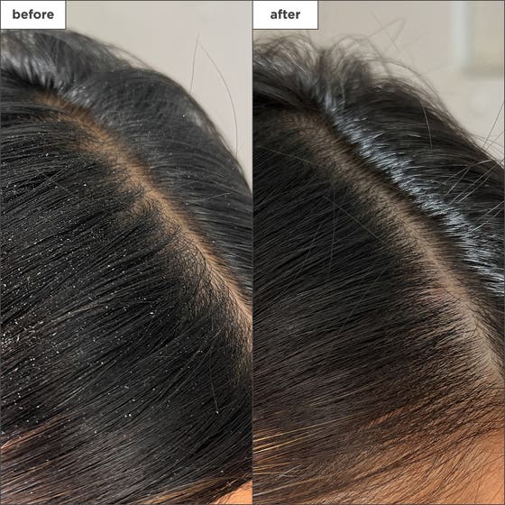 Scalp Revival™ Buildup Detox Spray