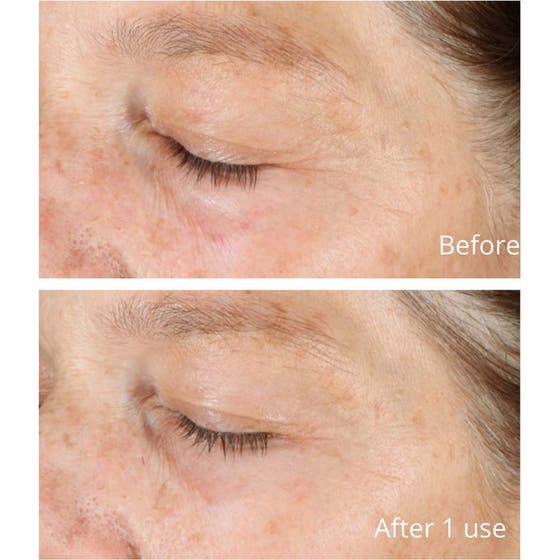 Environmental Shield