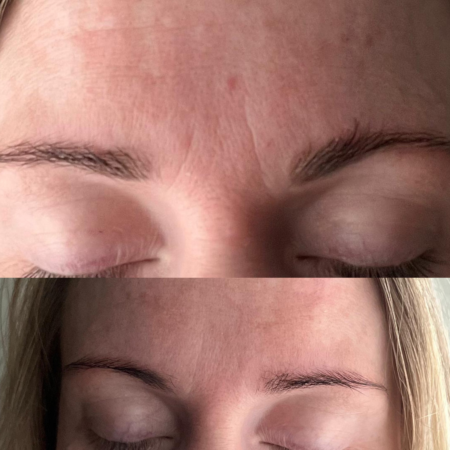Facial Beauty Tape