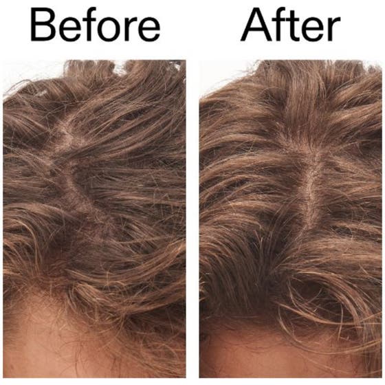 Glycolic Acid Exfoliating Scalp Scrub