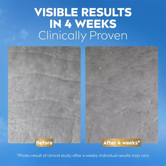 Q10 Collagen Expert Day & Night Facial Butter