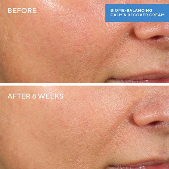 Biome-Balancing Calm + Recover Cream