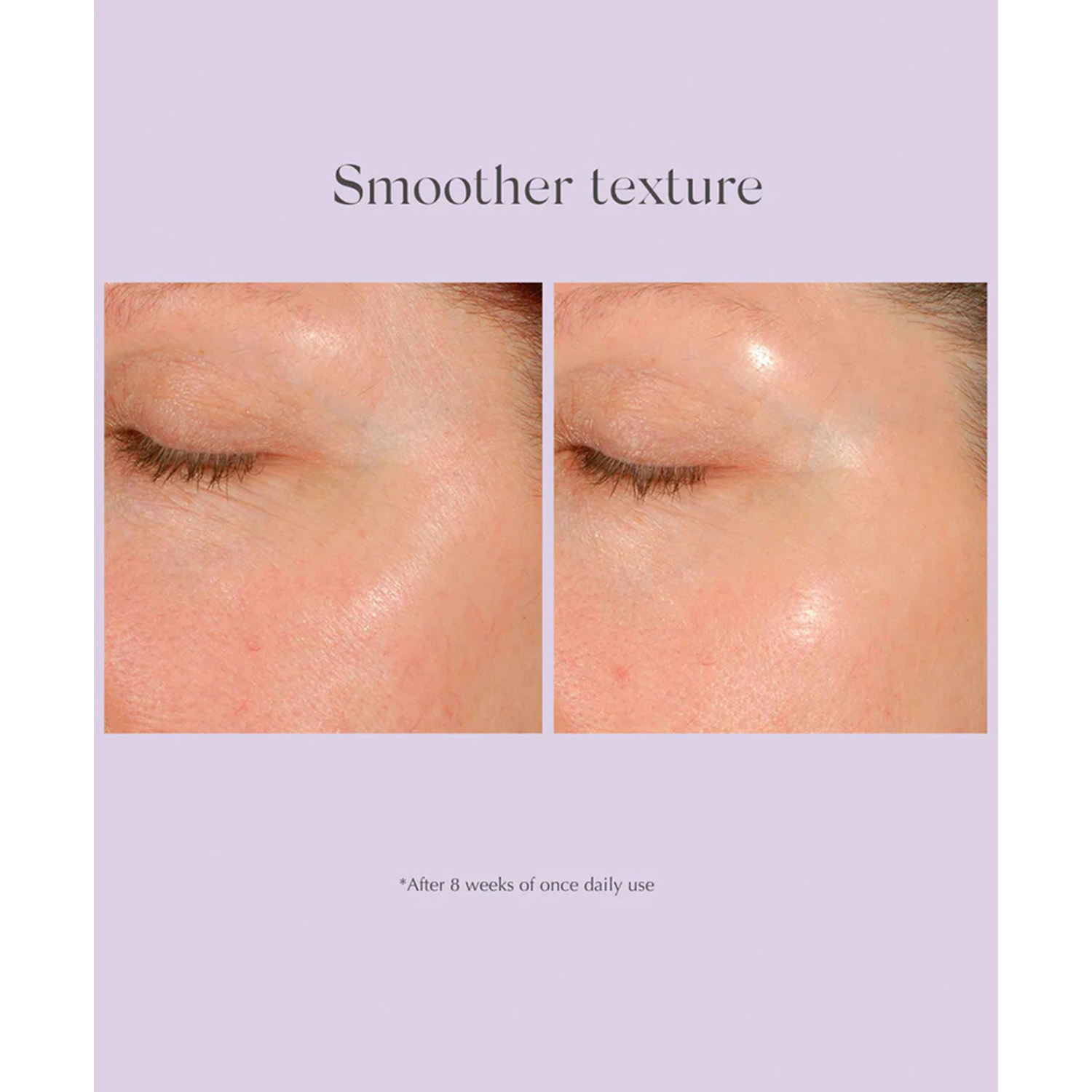 Daily Resurfacing Peel