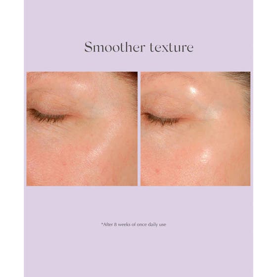 Daily Resurfacing Peel