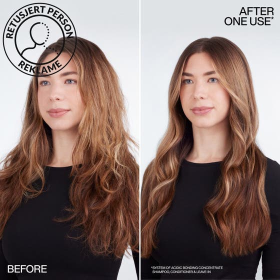 Acidic Bonding Concentrate Set