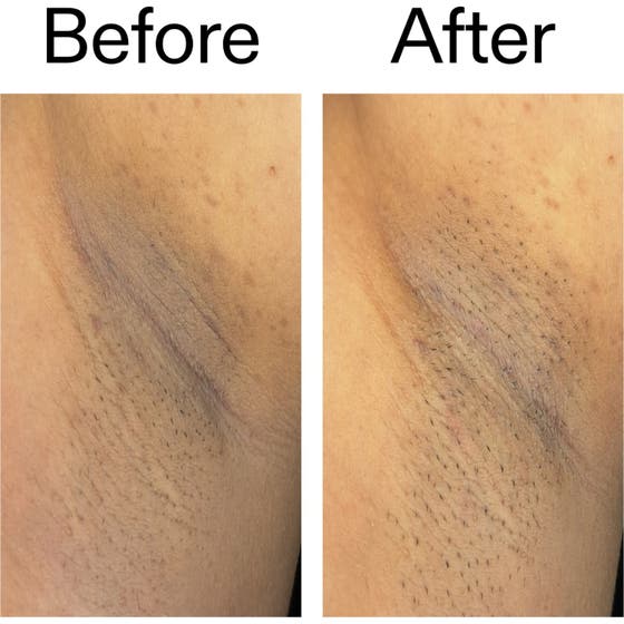 Glycolic Acid Exfoliating Body Stick