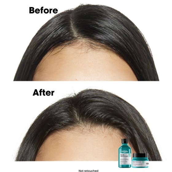 Scalp Advanced Anti-Oiliness Shampoo