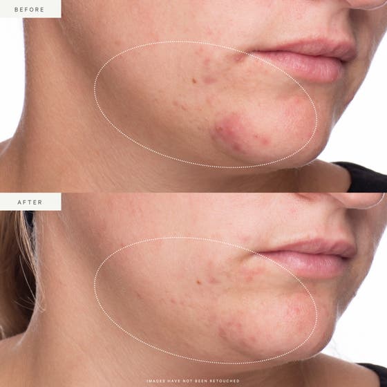 Active Algae Lightweight Moisturizer